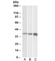 Western blot testing of A) human, B) mouse and C) rat skeletal muscle lysates with TNNT3 antibody at 0.01ug/ml. Predicted molecular weight: ~32kDa, routinely observed at 35~38kDa.