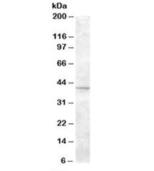 Western blot testing of mouse eye lysate with SLC24A5 antibody at 2ug/ml. Predicted molecular weight: ~55kDa, routinely observed at ~43kDa. (1)