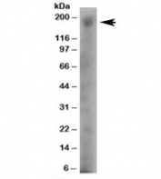 Western blot testing of human A431 lysate with DOCK1 antibody at 4ug/ml. Predicted molecular weight: 215kDa, routinely observed at 180~215kDa.