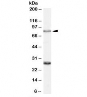 Western blot testing of rat brain lysate with SV2A antibody at 0.3ug/ml. Predicted molecular weight (rat): ~83kDa. Both observed bands are blocked by addition of the immunizing peptide.