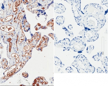 IHC staining of FFPE human placenta tissue with (left) and without (right) PIK3C2A antibody at 2ug/ml. Required HIER: