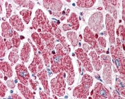 IHC testing of FFPE human heart with PIK3C2A antibody at 5ug/ml. HIER: steamed with pH6 citrate buffer, AP-staining