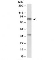 Western blot testing of human duodenum lysate with CLCA1 antibody at 1ug/ml. Predicted molecular weight: ~100/125kDa (unmodified/glycosylated). The precursor is cleaved at AA695 and this Ab is specific to the ~77/83kDa (unmodified/glycosylated) form.