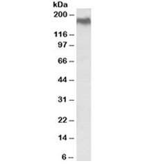 Western blot testing of HEK293 lysate with NPC1 antibody at 0.5ug/ml. Predicted molecular weight ~142/170~190kDa (unmodified/glycosylated).