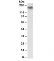 Western blot testing of HEK293 lysate with NPC1 antibody at 0.5ug/ml. Predicted molecular weight ~142/170~190 kDa (unmodified/glycosylated).