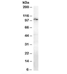Western blot testing of mouse brain lysate with Anillin antibody at 1ug/ml. Predicted molecular weight: ~124kDa, observed here at ~100kDa.