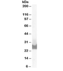 Western blot testing of A431 lysate with BID antibody at 0.1ug/ml. Predicted molecular weight ~26/22kDa (isoforms 1/2)