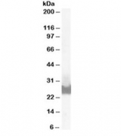 Western blot testing of A431 lysate with BID antibody at 0.1ug/ml. Predicted molecular weight ~26/22 kDa (isoforms 1/2)