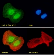 IHC testing of FFPE human small intestine tissue with KLF8 antibody at 3.75ug/ml. Required HIER: steamed antigen retrieval with pH6 citrate buffer; AP-staining.