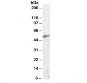 Western blot testing of human kidney lysate with KLF8 antibody at 2ug/ml. Predicted molecular weight: ~39 kDa but can be observed at up to 60 kDa.