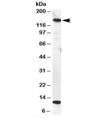 Western blot testing of HeLa lysate with MTR antibody at 2ug/ml. Predicted molecular weight: ~140kDa.~