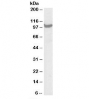 Western blot testing of A431 lysate with TRAP2 antibody at 0.03 ug/ml. Predicted/observed molecular weight: ~100kDa.