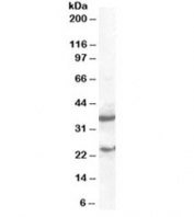 Western blot of mouse spleen lysate with SOCS1 antibody at 2ug/ml. Similar banding pattern seen in transfected cell lysate. Predicted molecular weight ~24 kDa, but also may be visualized at ~37 kDa.