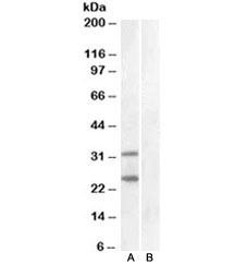Western blot of HEK293 lysate overexpressing human SOCS1 and tested with SOCS1 antibody at 1ug/ml (mock transfection in lane B). Similar banding pattern is seen in mouse spleen. Predicted molecular weight ~24kDa, but also may be visualized at ~37kDa.~