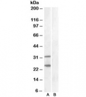 Western blot of HEK293 lysate overexpressing human SOCS1 and tested with SOCS1 antibody at 1ug/ml (mock transfection in lane B). Similar banding pattern is seen in mouse spleen. Predicted molecular weight ~24 kDa, but also may be visualized at ~37 kDa.