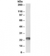 Western blot testing of mouse spleen lysate with biotinylated SOCS1 antibody at 1ug/ml. Predicted molecular weight ~24kDa, but also may be visualized at ~37kDa. An NAP blocker was used in place of non-fat milk as blocking solution and diluent. (1)