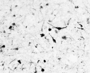 IHC testing of frozen human hypothalamic paraventricular nuclei with Tyrosine Hydroxylase antibody at 0.1ug/ml. A biotin secondary followed by SAv-HRP and DAB were used for the staining. Image courtesy of Prof. Erik Hrabovszky, Institute of Experimental Medicine, Budapest, Hungary.