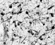 IHC testing of frozen human hypothalamic supraoptic nuclei with Tyrosine Hydroxylase antibody at 0.1ug/ml. A biotin secondary followed by SAv-HRP and DAB were used for the staining. Image courtesy of Prof. Erik Hrabovszky, Institute of Experimental Medicine, Budapest, Hungary.