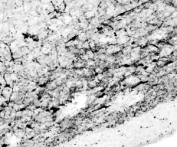 IHC testing of frozen human hypothalamic periventricular nuclei with Tyrosine Hydroxylase antibody at 0.1ug/ml. A biotin secondary followed by SAv-HRP and DAB were used for the staining. Image courtesy of Prof. Erik Hrabovszky, Institute of Experimental Medicine, Budapest, Hungary.