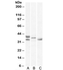 Western blot testing of A) human, B) mouse and C) rat heart lysates with Renalase antibody at 0.5ug/ml. Molecular weight: observed in human/mouse/rat samples between 33~38kDa.