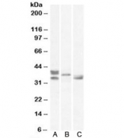 Western blot testing of A) human, B) mouse and C) rat heart lysates with Renalase antibody at 0.5ug/ml. Observed in human/mouse/rat samples between 33~38 kDa.