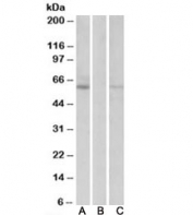 Western blot: transfected and FLAG tagged HEK293 lysate probed with Lane A: MKRN1 antibody [1ug/ml], Lane C: anti-FLAG [1/1000] and mock-transfected HEK293 probed with MKRN1 antibody [1ug/ml] in Lane B. Observed molecular weight: 50~60kDa.