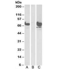 Western blot of HEK293 lysate overexpressing human EPM2AIP1-FLAG probed with EPM2AIP1 antibody [1ug/ml] in (A) and anti-FLAG [1/1000] in (C). Mock-transfected HEK293 probed with EPM2AIP1 antibody [1ug/ml] in (B). Predicted/observed molecular weight: ~70kDa.