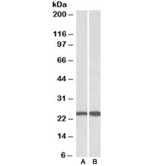 Western blot of mouse (A) and rat (B) testis lysate with RAN antibody at 0.1ug/ml. Predicted molecular weight ~25kDa.