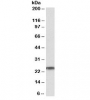 Western blot testing of human testis lysate with RAN antibody at 1ug/ml. Predicted molecular weight ~25kDa.