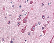 IHC testing of FFPE human brain (cortex) tissue with OGT antibody at 5ug/ml. Required HIER: steamed antigen retrieval with pH6 citrate buffer; AP-staining.