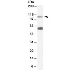 Western blot testing of rat pancreas lysate with OGT antibody at 0.05ug/ml. Molecular weight: the expected ~117kDa band and the additional ~60kDa band are both blocked by the immunizing peptide.~
