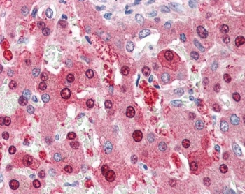 IHC testing of FFPE human liver tissue with HEC1 antibody at 5ug/ml. Required HIER: steamed antigen retrieval with pH6 citrate buffer; AP-staining.