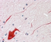 IHC staining of FFPE human cerebellum with SHP2 antibody at 3.8ug/ml. HIER: steamed with pH6 citrate buffer, AP-staining.
