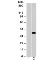 Western blot of HEK293 lysate overexpressing HADH tested with HADH antibody (mock transfection in lane 1).