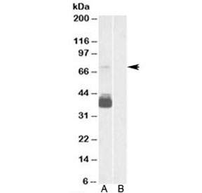 Western blot testing of human brain frontal cortex lysate with P2RX7 antibody at 0.3ug/ml with [B] and without [A] blocking/immunizing peptide. Predicted/observed molecular weight: ~69kDa.