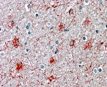 IHC staining of FFPE human brain cortex with P2RX7 antibody at 4ug/ml. HIER: steamed with pH6 citrate buffer, AP-staining.