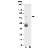 Western blot testing of human brain frontal cortex lysate with P2RX7 antibody at 0.3ug/ml with [B] and without [A] blocking/immunizing peptide. Predicted/observed molecular weight: ~69 kDa.
