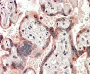 IHC testing of FFPE human placenta with Cripto-1 antibody at 4ug/ml. HIER: steamed with pH6 citrate buffer, AP-staining.