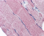 IHC testing of FFPE human skeletal muscle and PCSK6 antibody at 5ug/ml. HIER: steamed with pH6 citrate buffer, AP-staining.