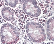 IHC testing of FFPE human small intestine with SLC10A2 antibody at 4ug/ml. HIER: steamed with pH6 citrate buffer, AP-staining. Staining of cells in the laminia propria between the intestinal vili is seen.