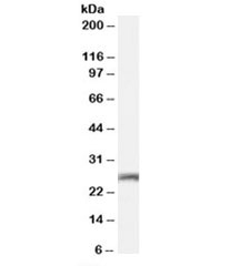 Western blot testing of mouse brain lysate with Connexin 26 antibody at 0.01ug/ml. Predicted molecular weight: ~26kDa.