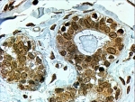 IHC testing of FFPE human breast with CYP7B1 antibody at 4ug/ml. HIER: steamed with pH6 citrate buffer, HRP-staining.
