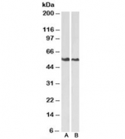 Western blot testing of A) HeLa and B) Jurkat cell lysate with Annexin A11 antibody. Predicted molecular weight: ~54kDa.