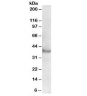 Western blot testing of human skeletal muscle lysate with Rapsyn antibody at 0.5ug/ml. Predicted molecular weight: ~40kDa, routinely observed at 40-43kDa.