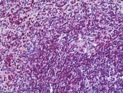 IHC staining of FFPE human spleen with LFA-1 antibody at 3.75ug/ml. HIER: steamed with pH6 citrate buffer, AP-staining.