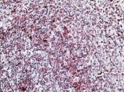 IHC staining of FFPE human spleen with LFA-1 antibody at 4ug/ml. HIER: steamed with pH6 citrate buffer, AP-staining.