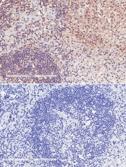 IHC staining of FFPE human lymph node with (top) and without (bottom) LFA-1 antibody at 2ug/ml. HIER: steamed with pH6 citrate buffer, HRP-staining.