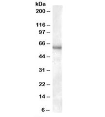Western blot testing of human kidney lysate with P2RX4 antibody at 0.3ug/ml. Expected molecular weight: 43-70 kDa depending on glycosylation level.~