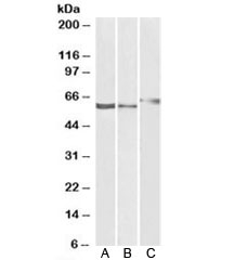 Western blot testing of human A) kidney, B) liver and rat C) kidney lysate with P2RX4