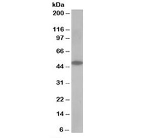 Western blot testing of human muscle lysate with OSBPL1A antibody at 0.5ug/ml. Predicted/observed molecular weight: ~48kDa.